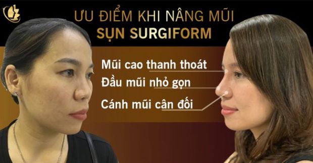nang-mui-boc-sun-surgiform (3)